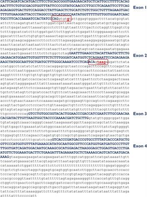 UGT1A1 Variants c.864+5G>T and c.996+2_996+5del of a Crigler-Najjar Patient Induce Aberrant Splicing in Minigene Assays